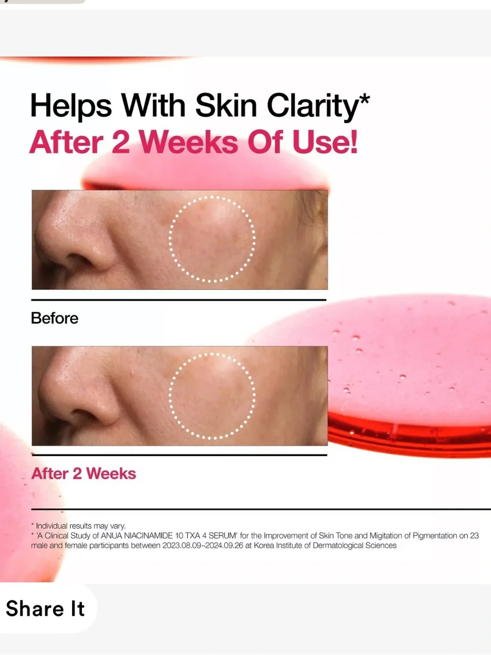 Anua 10+ niacinamide